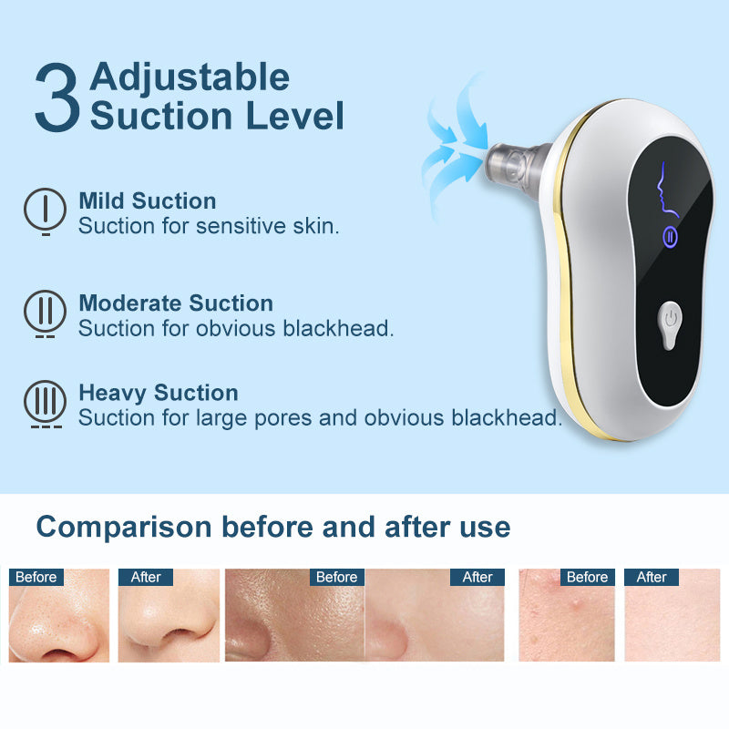 Electric Suction Blackhead Remover Kit