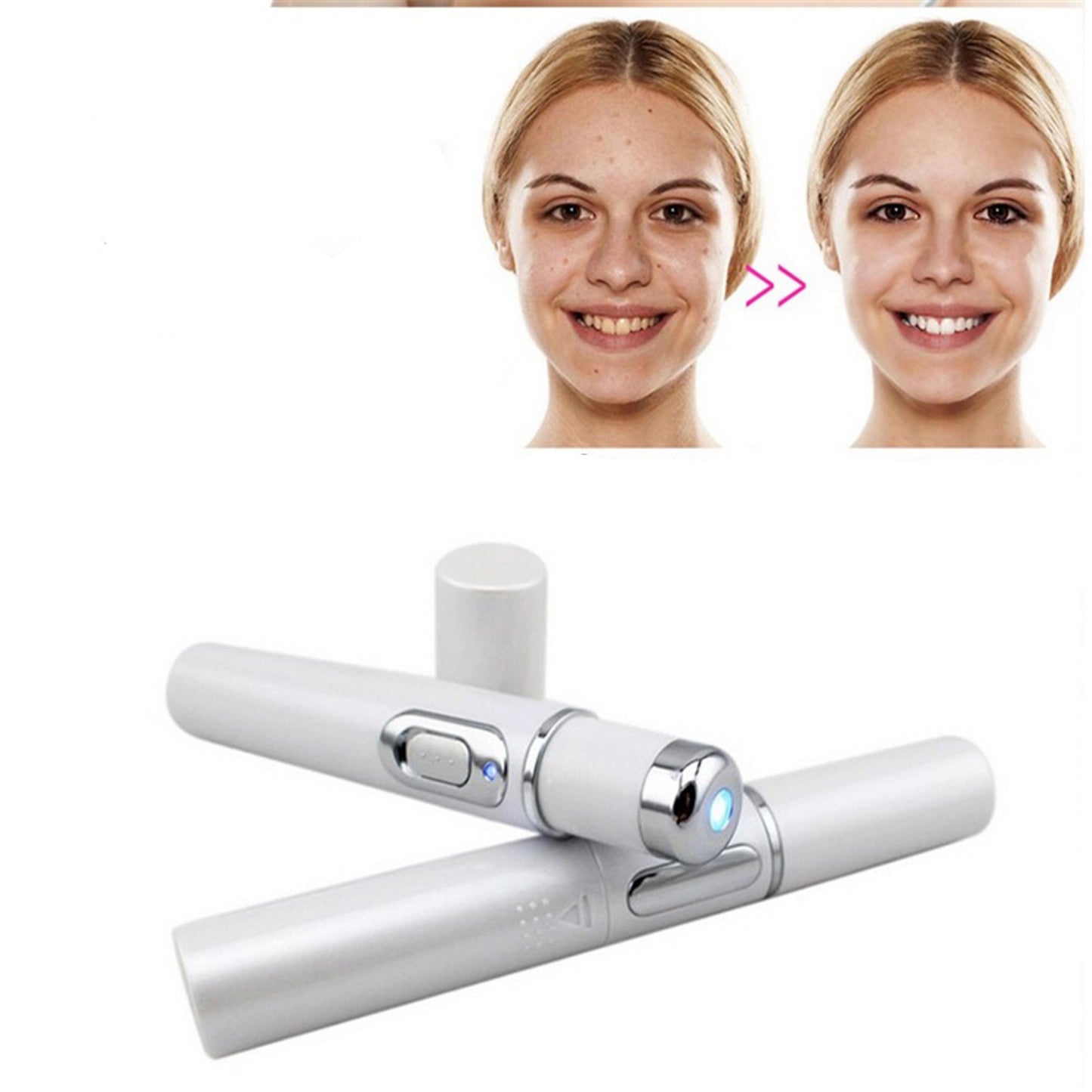 Wrinkle & Blemish Remover Pen